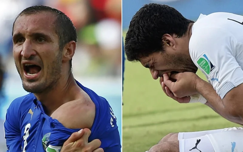 luis-suarez-futbolo-kandžiojimasis luis-suarez-futbolo-kandžiojimasis